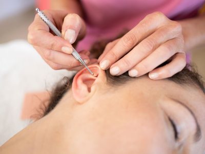 Auriculoterapia